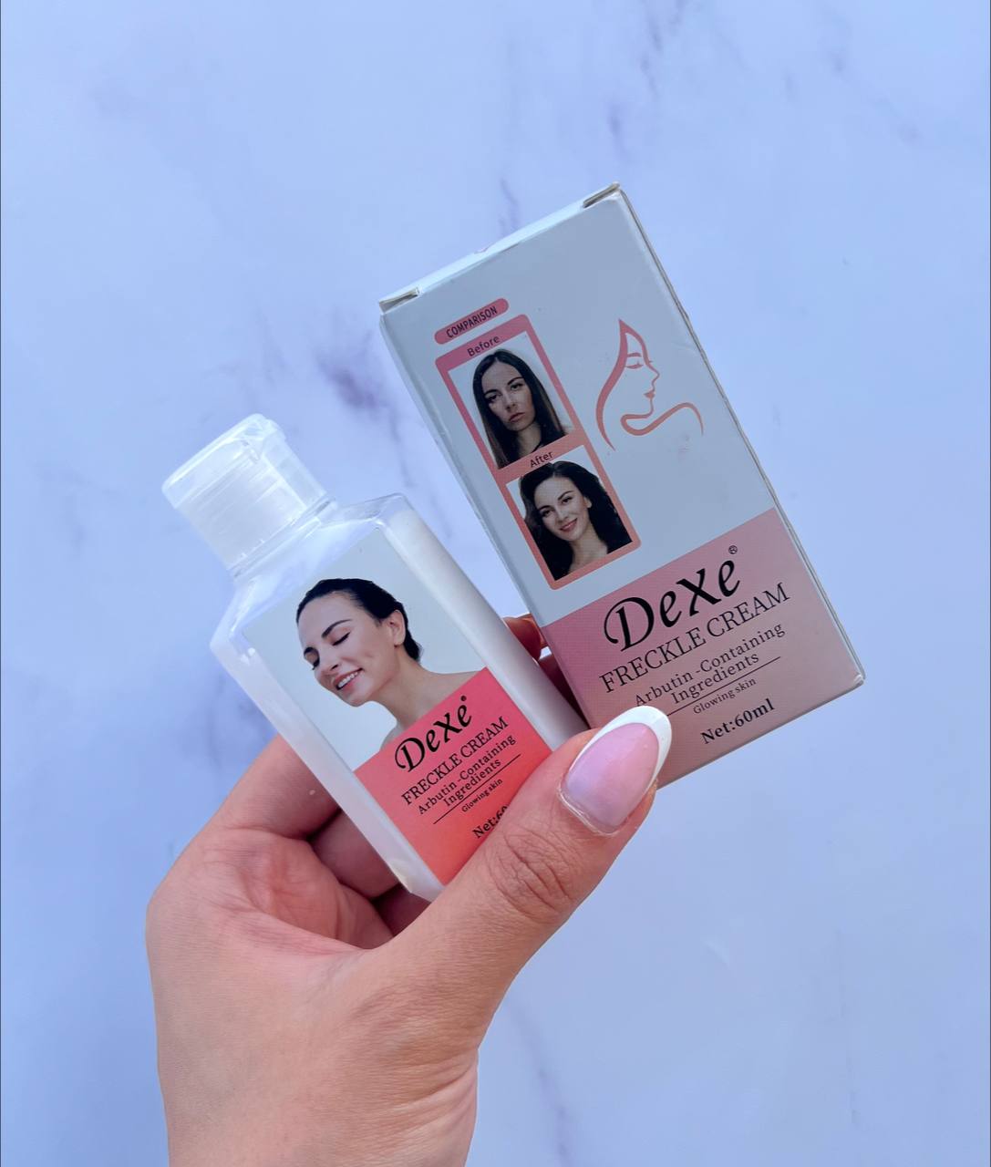 کرم ضد لک و کک و مک تخصصی Dexe