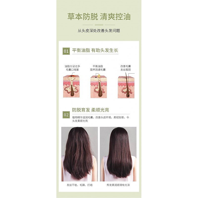 شامپو ضد ریزش مو اصلی bioaqua hair loss prevention shampoo
