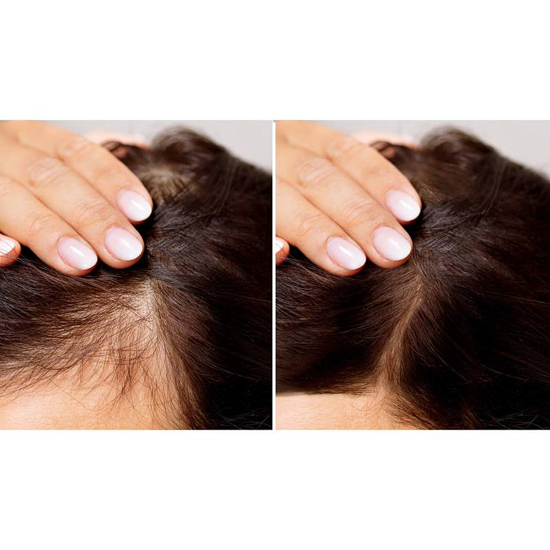 شامپو ضد ریزش مو اصلی bioaqua hair loss prevention shampoo