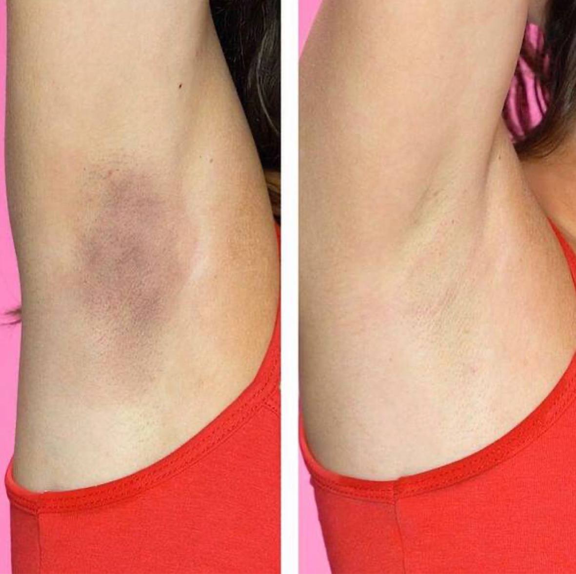 پک تخفیفی نمک اسکراب بدن + کرم آمونیوم 12٪