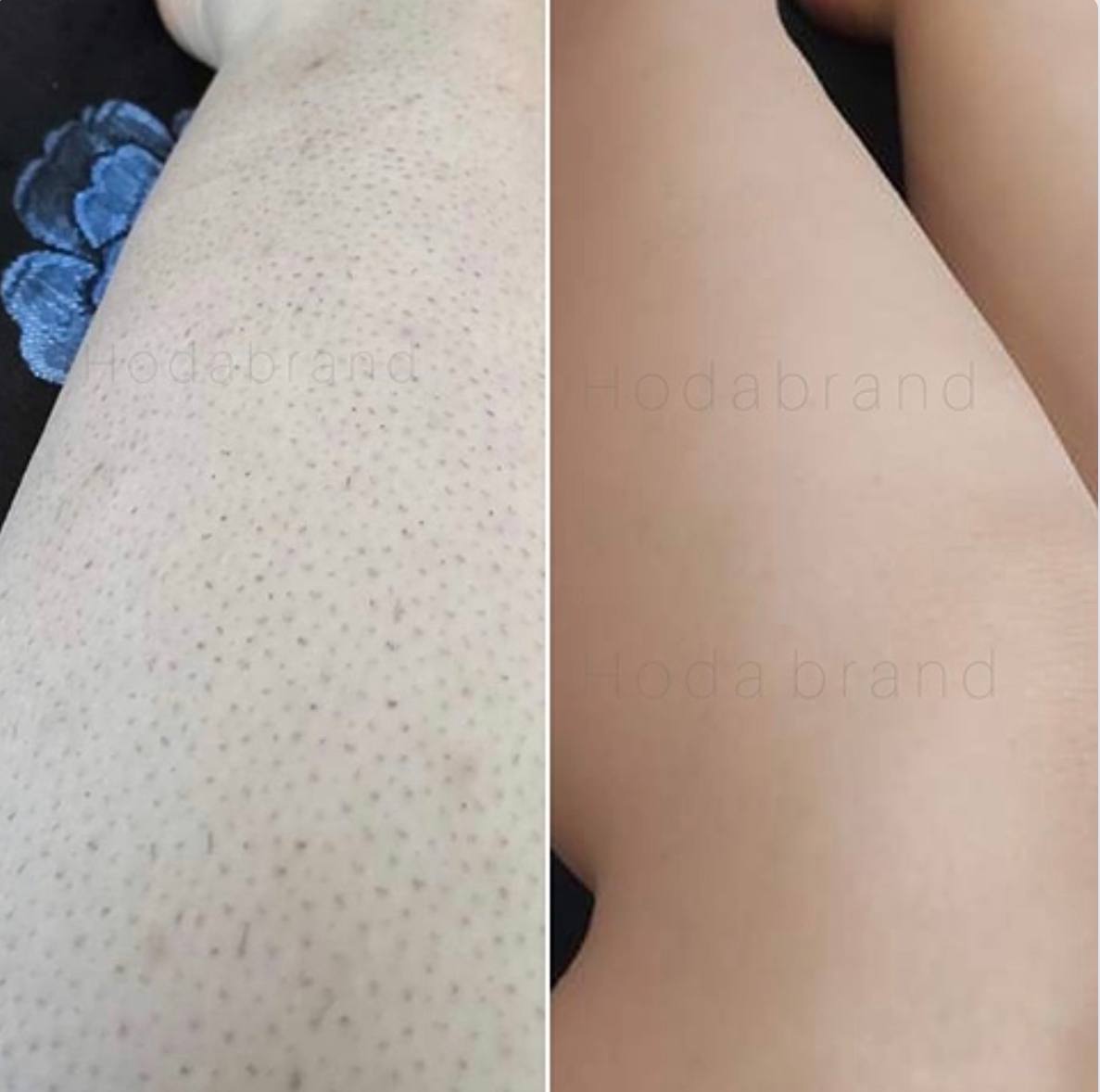 فوم اسکراب قهوه ( ترکیب لوسیون + اسکراب)