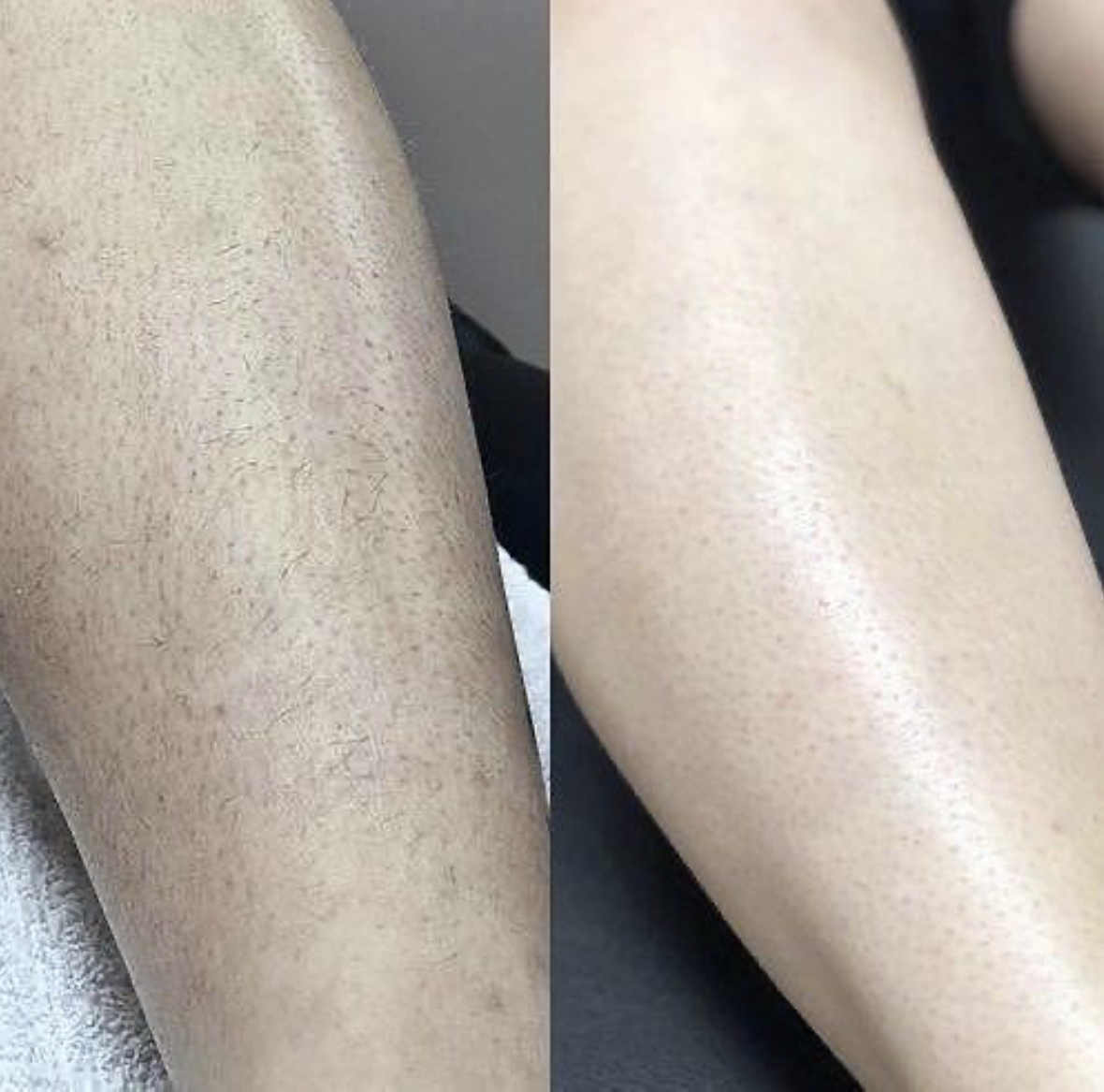 شوگر اسکراب میوه ای 350گرمی