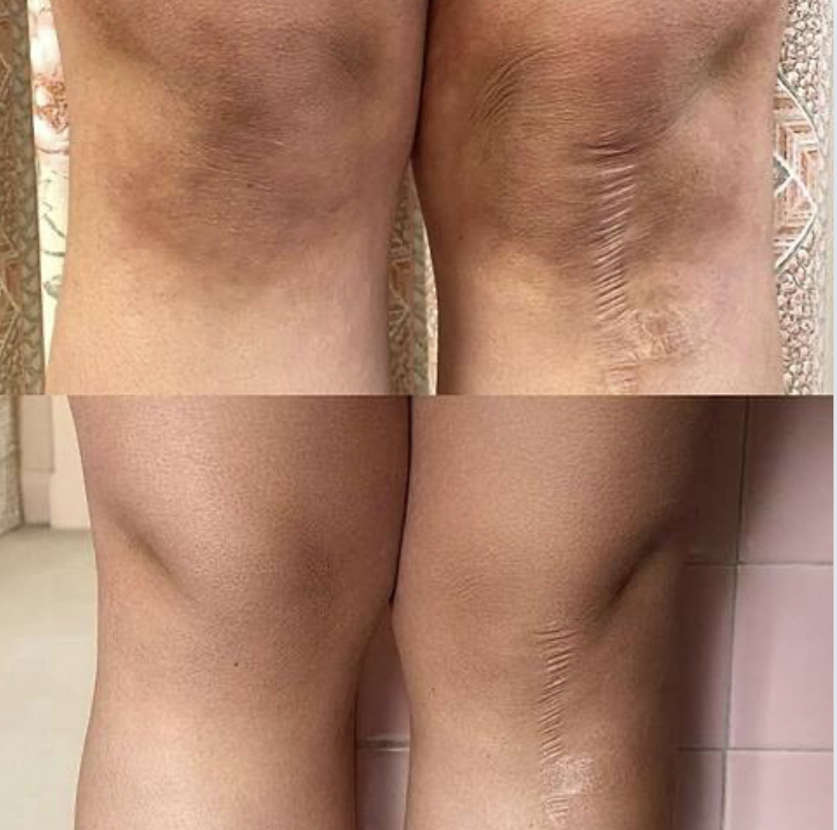شوگر اسکراب میوه ای 350گرمی