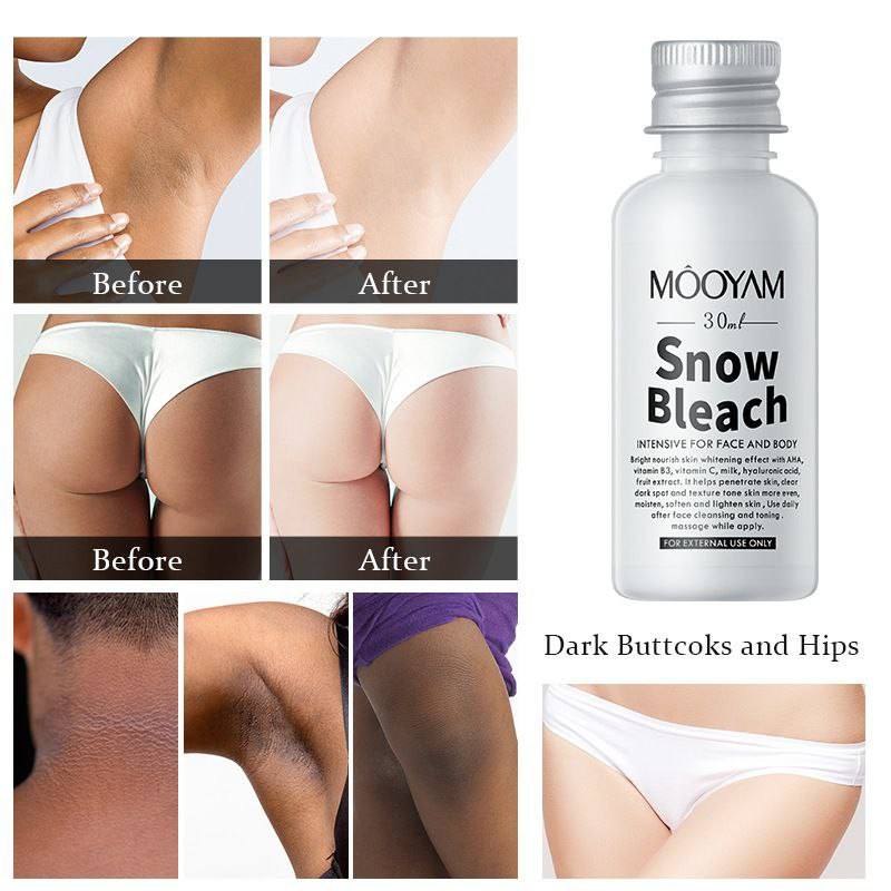 پک تخفیفی کرم ژیناژن + برف بدن