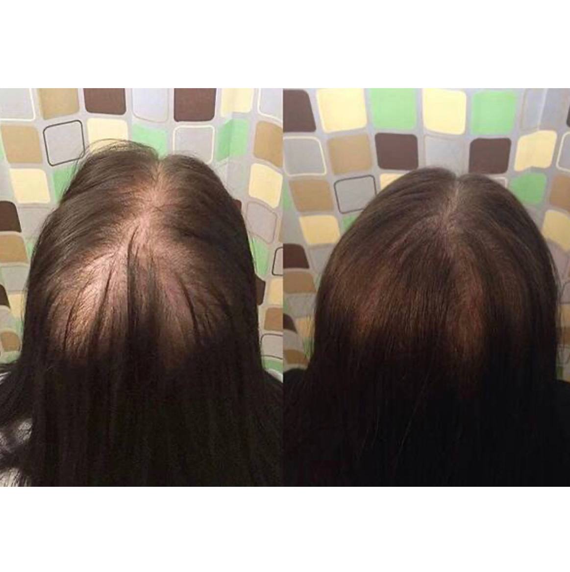 ویال ضدریزش مو کوئین مدل PROTEIN KERATIN