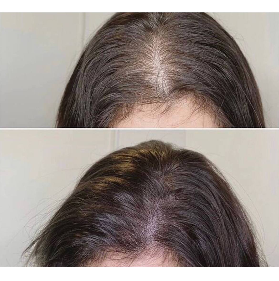ویال ضدریزش مو کوئین مدل PROTEIN KERATIN