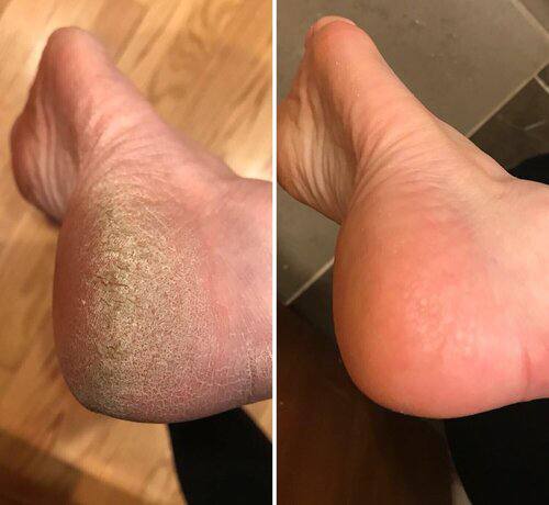 جوراب سیلیکونی نمونه اصلی جعبه دار
