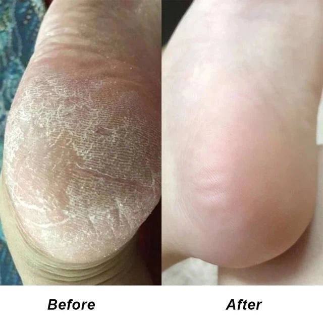 صابون اسکراب شنی پا