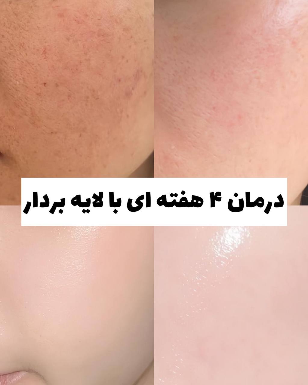 کرم اسکراب صورت