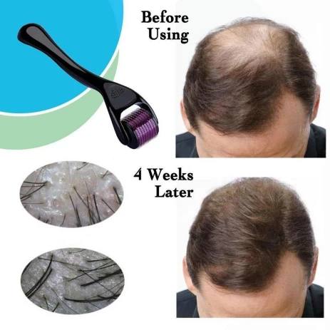 پک تخفیفی درمارولر + ویال کلاژن