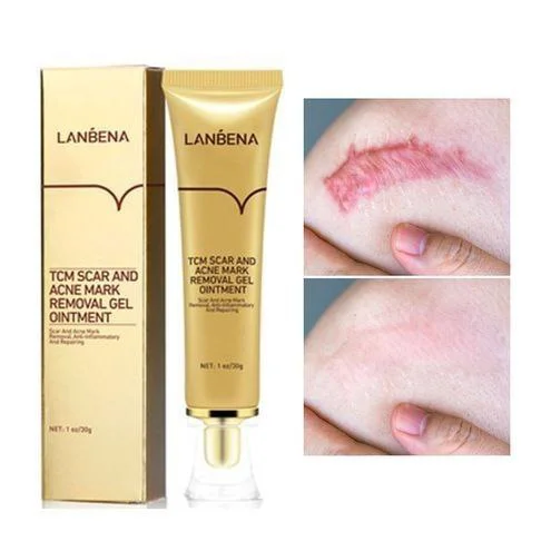 ژل ترمیم کننده جای جوش و اسکار لانبنا LANBENA