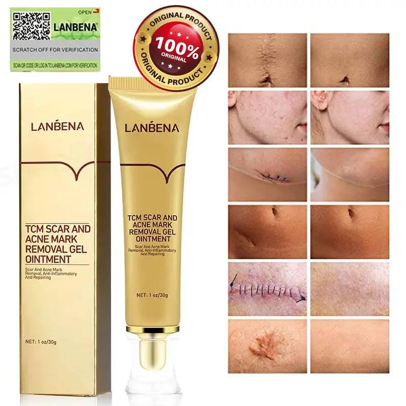 ژل ترمیم کننده جای جوش و اسکار لانبنا LANBENA