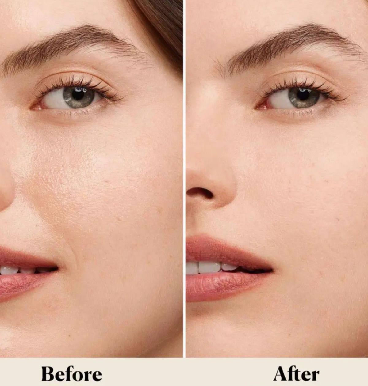 استیک کوچک کننده فوری منافذ سنتلا