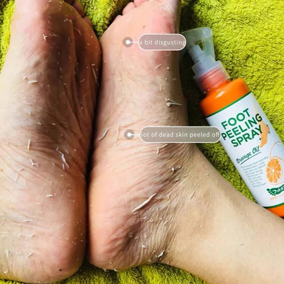 اسپری ترک و خشکی پا foot peeling spray